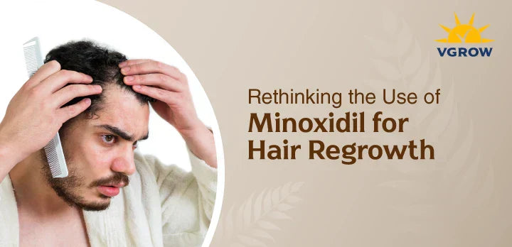 Rethinking the Use of Minoxidil for Hair Regrowth