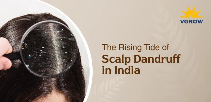 The Rising Tide of Scalp Dandruff in India