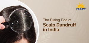 The Rising Tide of Scalp Dandruff in India