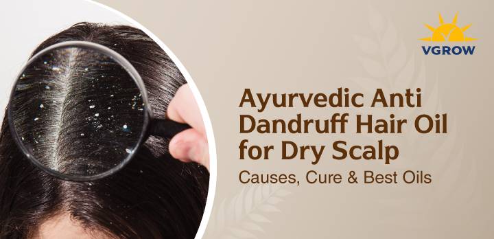 Ayurvedic Anti-Dandruff Hair Oil for Dry Scalp: Causes, Cure & Best Oils