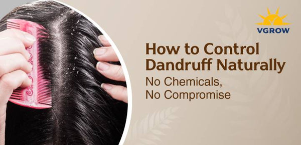 How to Control Dandruff Naturally — No Chemicals, No Compromise