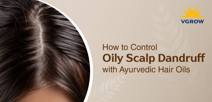 How to Control Oily Scalp Dandruff with Ayurvedic Hair Oils