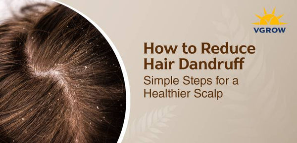 How to Reduce Hair Dandruff — Simple Steps for a Healthier Scalp