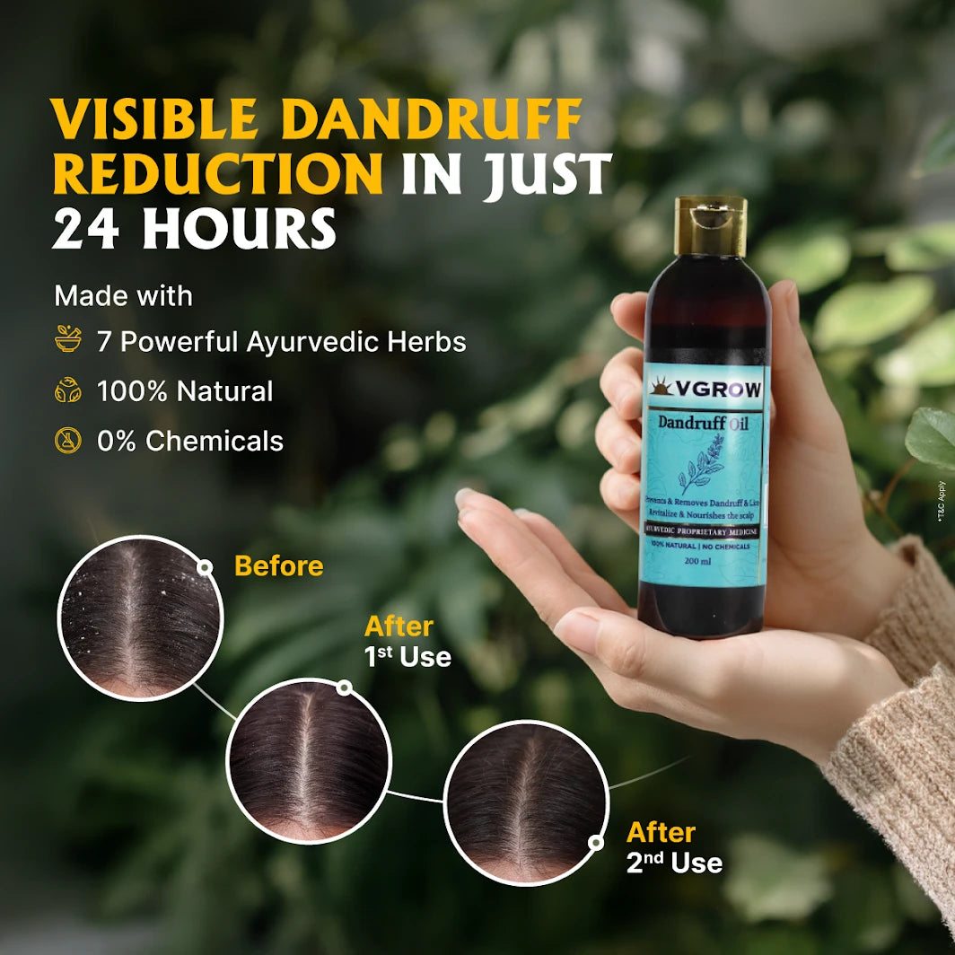 ayurcveid dandruff hair oil