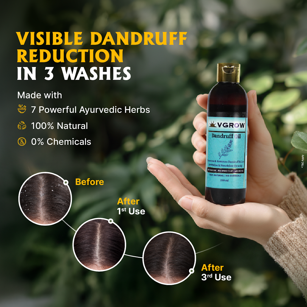Ayurvedic Dandruff Hair Oil