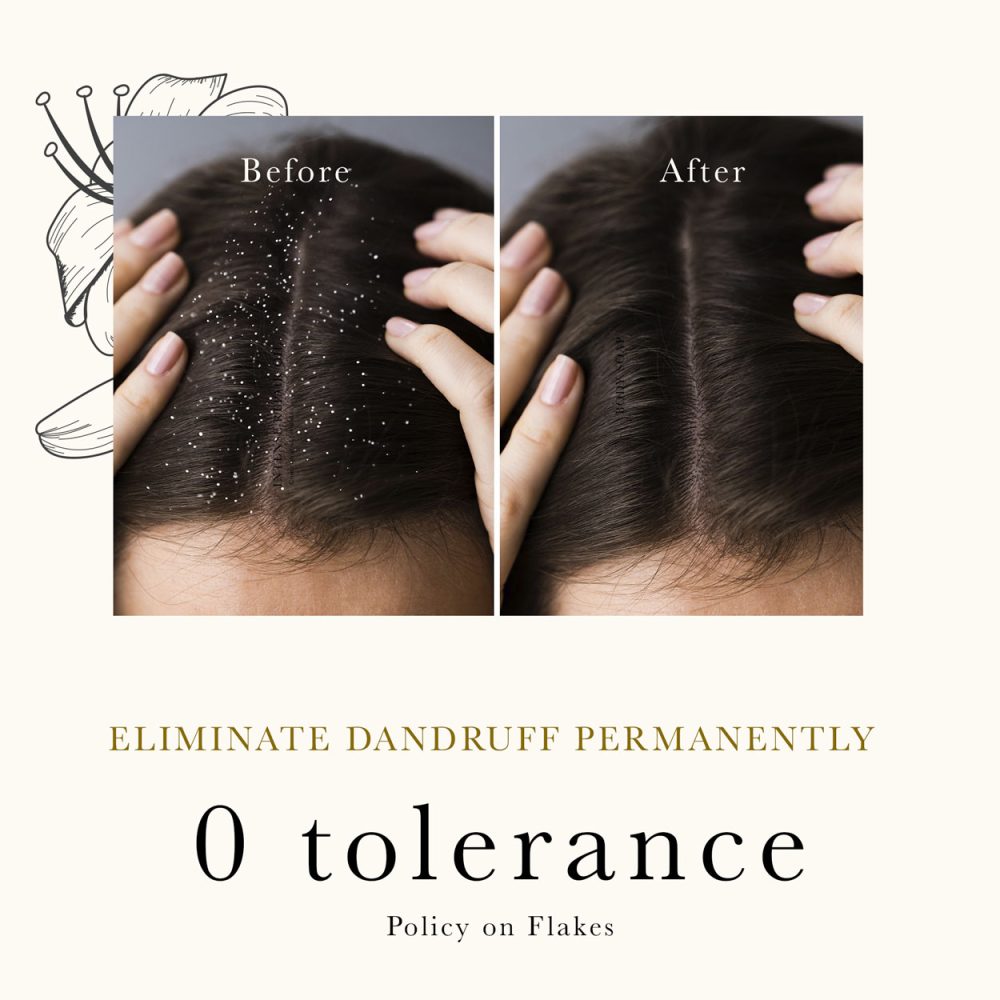 Embrace the power of nature with our Anti Dandruff Hair Oil, a blend of herbal ingredients for healthy, flake-free hair.