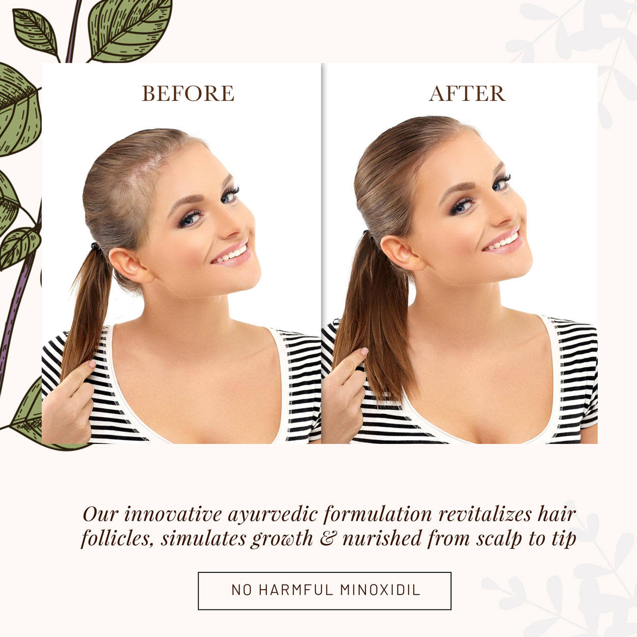 hair-oil-5 Witness a visible transformation in hair density and strength. We invite you to accept the 21-Day VGROW Challenge. Use the oil as directed, and if your hair doesn't show signs of new growth, our money-back guarantee has you covered. You have nothing to lose but hair fall.